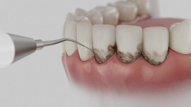 Reliable Wisdom Tooth Removal contractor in Perry County County, MS by Dentist Open Now
